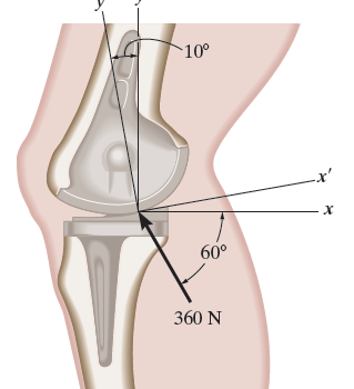 The device is used for surgical replacement
