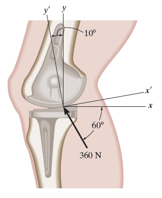 The device is used for surgical replacement