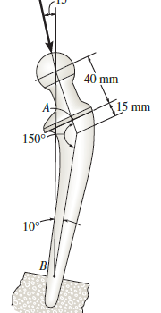 The total hip replacement is subjected